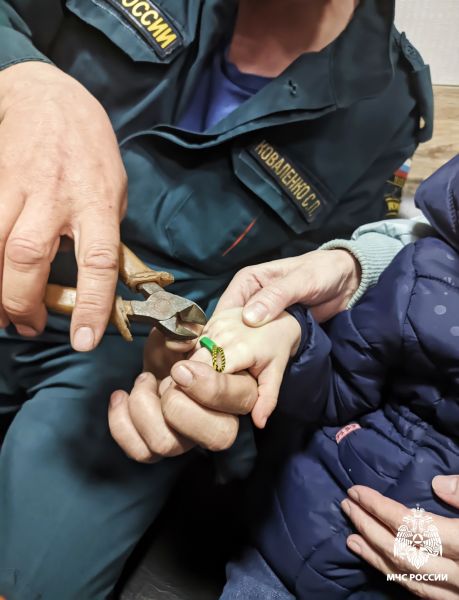 В Курске маленькая девочка не смогла снять игрушечное кольцо с пальца