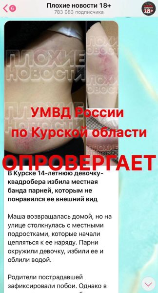 Курские полицейские опровергли фейк о девочке-квадробере