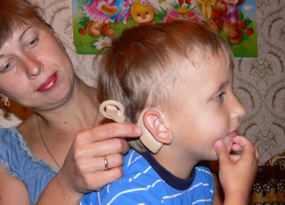 Часть прибора, которая крепится за ухом, стоит 500 тысяч рублей